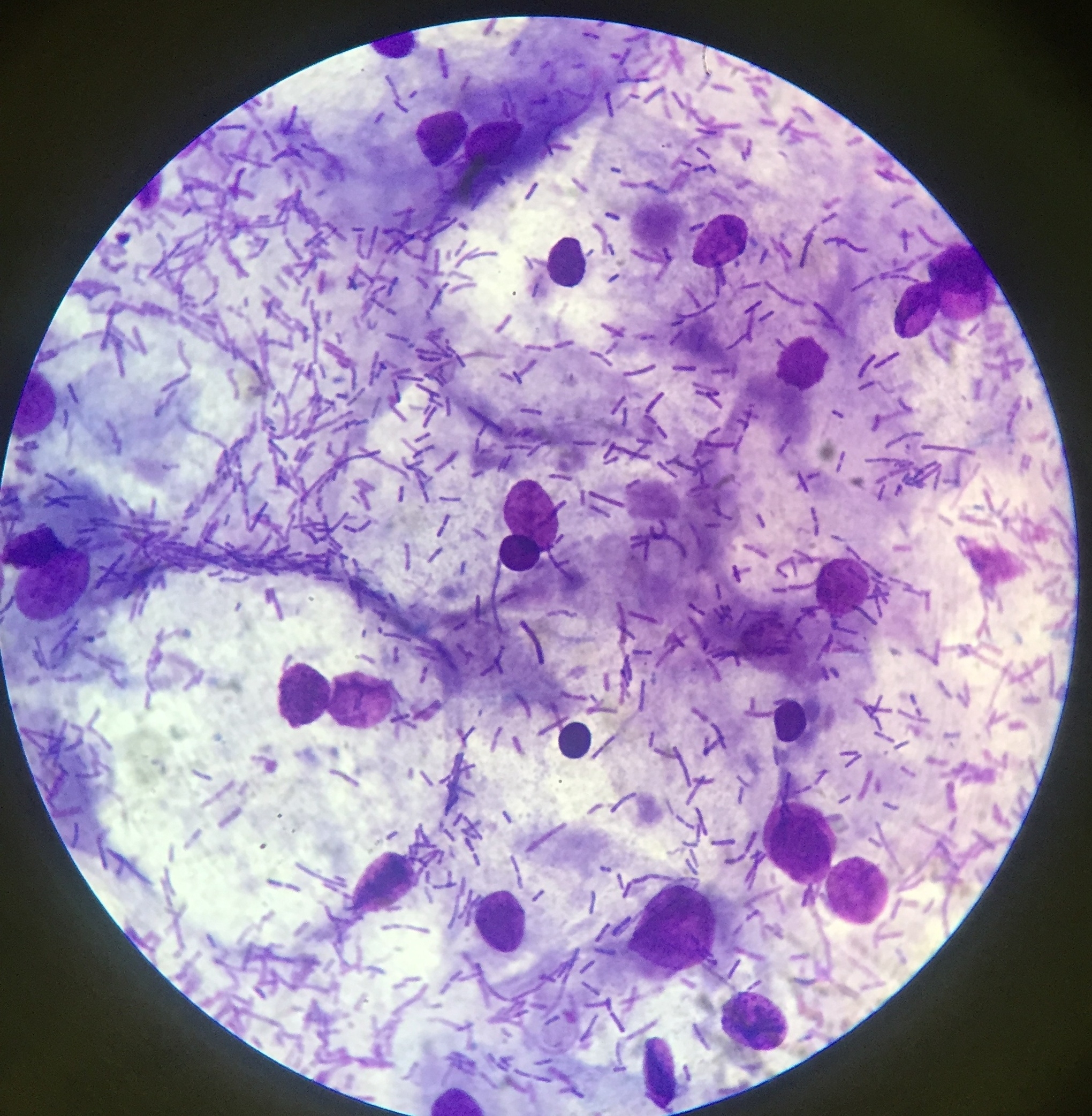 Урогенитальный хламидиоз микроскопия